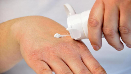 علت و رفع خشکی پوست دست